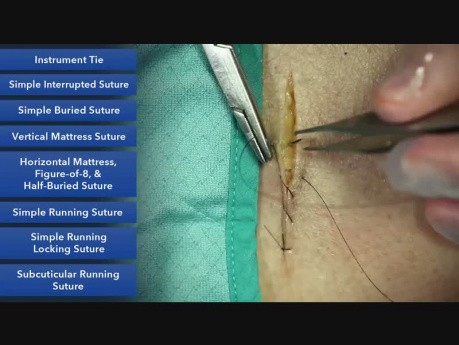 Sutura simple continua - técnicas de sutura