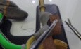 Técnica de Roscoe Graham modificado para reparación de Ulcus Péptico perforado en modelo supramecólico en 3D