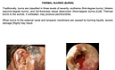 Enfermedades del oído - Volumen 1 - La Pinna