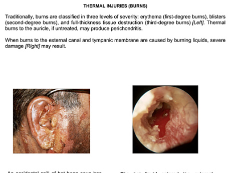 Enfermedades del oído - Volumen 1 - La Pinna