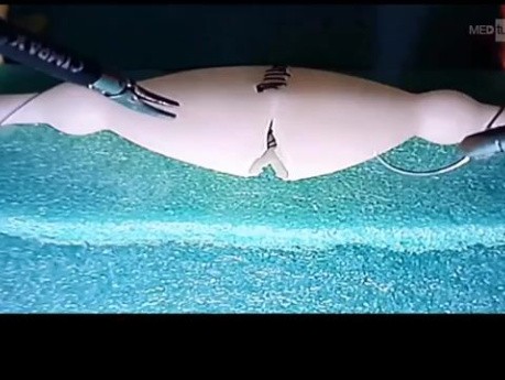 Anastomosis intracorpórea en una caja de entrenamiento