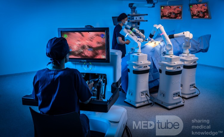 Prostatectomía en urología de CMR Surgical