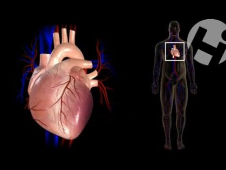 Fibrilación ventricular