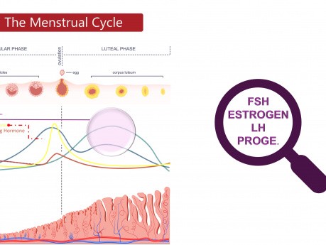 Adolescencia con sangrado menstrual abundante