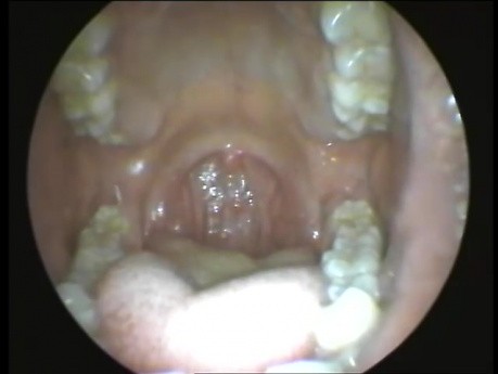 Cavidad oral y orofaringe: una visión panorámica.