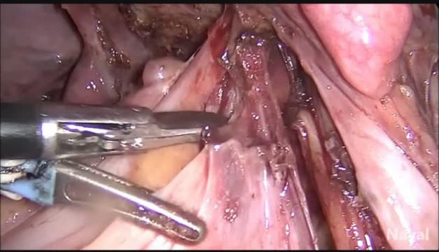 Ooforoplastia - Clínica Wajman - Cirurgias nos ovários