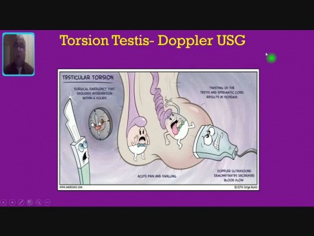Inflamaciones escrotales - Torsión testicular 