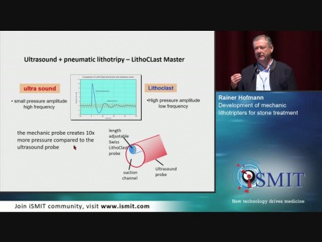 Desarrollo de litotripsters mecánicos para el tratamiento de cálculos - SMIT 2019