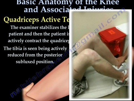 Anatomía de la rodilla y lesiones