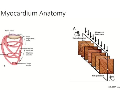 Una guía práctica para la "Global Longitudinal Strain (GLS)" ecocardiográfica mediante "Speckle Tracking 2D"