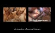 Vídeos quirúrgicos de anatomía