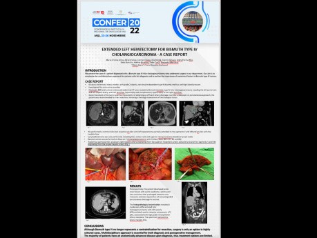 Presentación de caso Hepatectomía izquierda ampliada por colangiocarcinoma de bismuto tipo IV