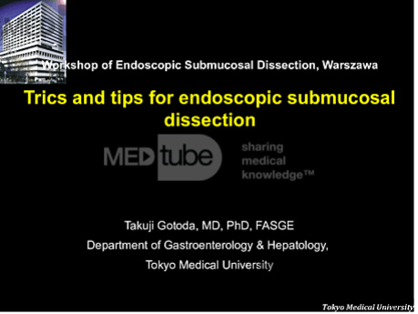 Trucos y consejos para la disección submucosa endoscópica