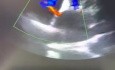 Un defecto del tabique auricular residual después de la septostomía