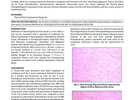 Lipomatosis difusa de la glándula tiroidea enmascarada como malignidad