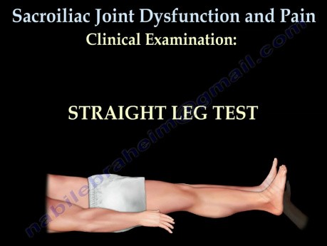 Disfunción de la articulación sacroilíaca - video-clase