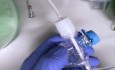 Broncoscopia más segura en pacientes con traqueotomía durante la COVID-19