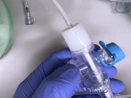 Broncoscopia más segura en pacientes con traqueotomía durante la COVID-19