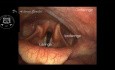 Anatomía endoscópica otorrinolaringológica