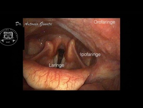 Anatomía endoscópica otorrinolaringológica