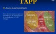 Cirugía de hernia TAPP (Conferencia)
