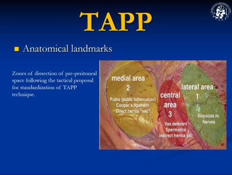 Cirugía de hernia TAPP (Conferencia)