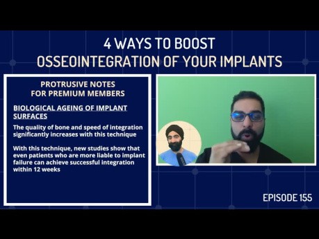 ¡4 formas de impulsar la osteointegración de sus implantes!