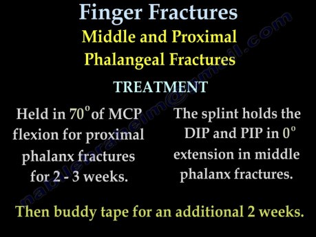 Fracturas metacarpianas y fracturas de los dedos - video-clase