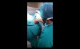 Fístula anal extendiéndose a genitales externos femeninos - labios mayores