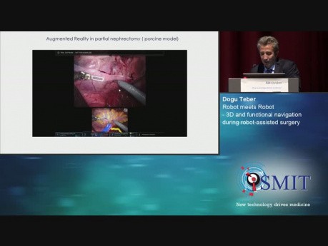 3D y navegación funcional durante la cirugía asistida por robot - SMIT 2019