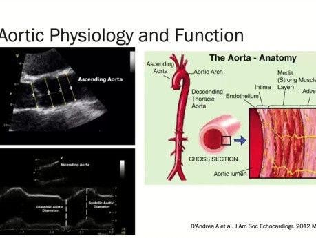 Ecocardiografía para enfermedades aórticas: lo que desea saber sobre la aorta