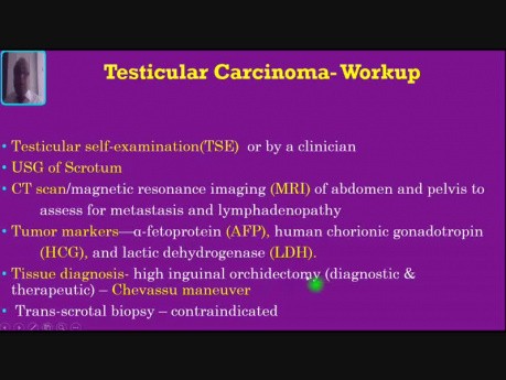 Inflamación Escrotal - Cáncer de Testículo