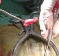 Microdiscectomía Lumbar