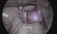 Podstawowa anatomia laparoskopowa