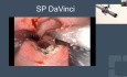 Clase magistral de VF sobre el manejo del cáncer rectal