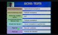 Varices en miembros inferiores