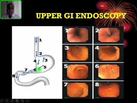 Descripción General de la Endoscopia Digestiva Alta