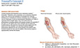 Youssef's Concept 2