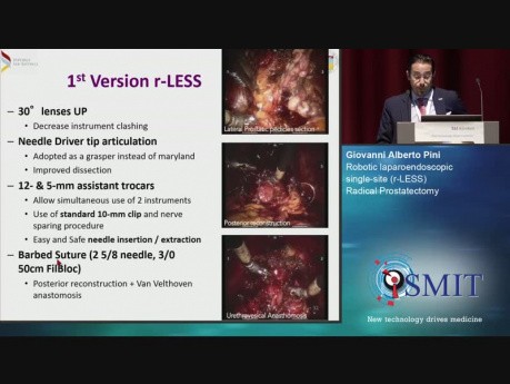 Laparoendoscópica robótica por un puerto único (r-LESS) de la prostatectomía radical - SMIT 2019