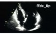 4. Caso de ecocardiografía - ¿Qué se ve?