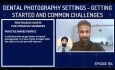 Configuración de fotografía dental: primeros pasos y desafíos habituales