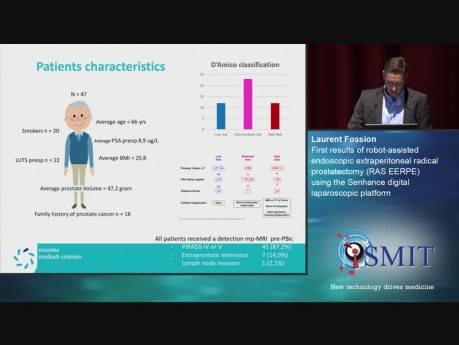 Primeros resultados de la prostatectomía radical extraperitneal endoscópica asistida por robot utilizando la plataforma laparoscópica digital Senhance (Senhance Digital Laparoscopic Platform) - SMIT 2019