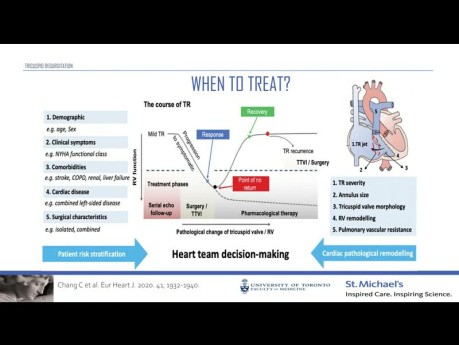 Importancia de la insuficiencia tricuspídea en pacientes con insuficiencia cardíaca