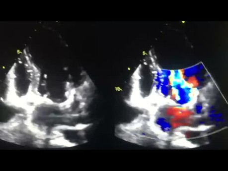 ¿Puedes adivinar el caso de la ecocardiografía?