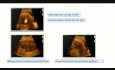 Foramen oval restrictivo en periodo fetal y proceso post natal