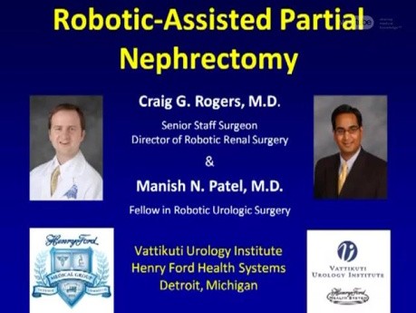 Nefrectomía parcial asistida por robot - Paso 1