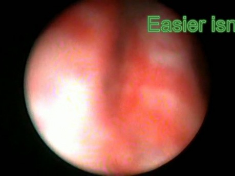 Ureteroscopia - Parte 1