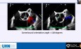Reparación de la válvula aórtica regurgitante: ¿Arte o ciencia? El papel de la ETE intraoperatoria