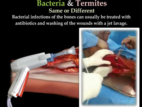 Infección por termitas y bacterias - video-clase