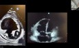 Hocus Pocus: Użycie POCUS dla oceny objętości i hemodynamiki oraz szybkiej diagnozy osobliwej